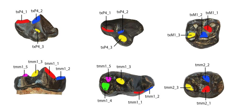 Six black teeth with chewing surfaces marked in color